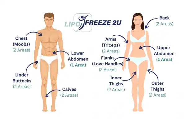 Areas you can have fat freezing treatment Woodford