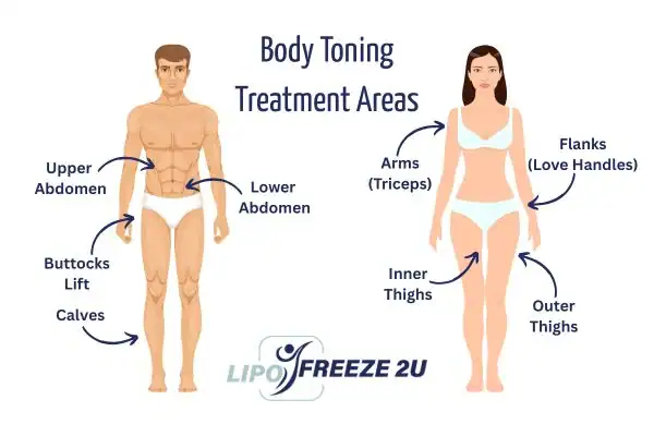Graphic showing where you can have Body toning Treatment Woodford on your body