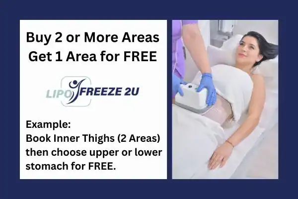 fat freezing prices Woodford