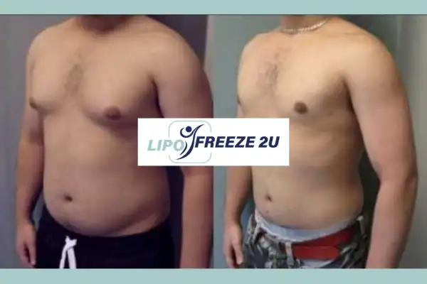 How Long Does It Take to See Results Woodford?