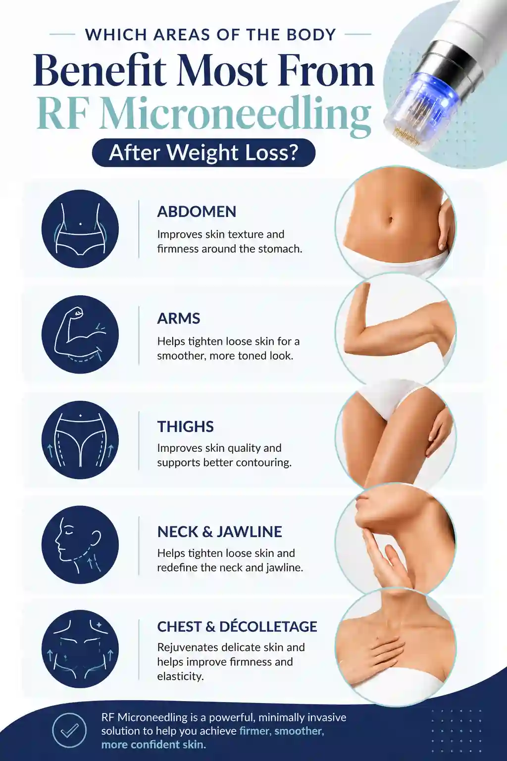 Which Areas of the Body Benefit Most From RF Microneedling After Weight Loss Woodford